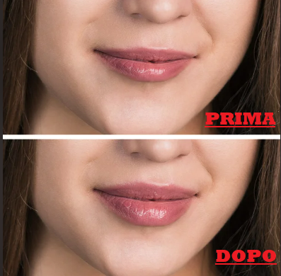 FerlyCosmetics lucidalabbra volumizzante gonfia labbra lip gloss con peperoncino,zenzero e caffeina che idrata e dona volume